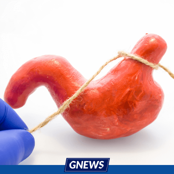 perda de peso cirurgia bariátrica
