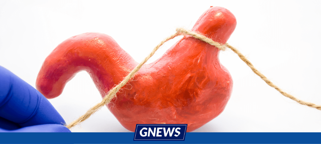 perda de peso cirurgia bariátrica