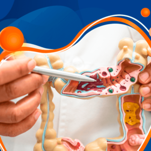 Princípios e Práticas Nutricionais na Doença Inflamatória Intestinal